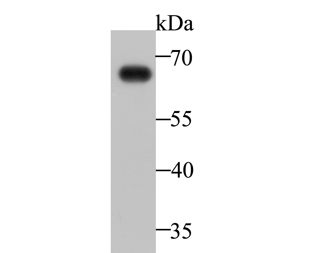 Fig1: Western blot analysis of IgA on human plasma lysate. Proteins were transferred to a PVDF membrane and blocked with 5% BSA in PBS for 1 hour at room temperature. The primary antibody was used at a 1:500 dilution in 5% BSA at room temperature for 2 hours. Goat Anti-Mouse IgG - HRP Secondary Antibody (HA1006) at 1:5,000 dilution was used for 1 hour at room temperature.