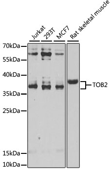 Western blot - TOB2 Polyclonal Antibody 