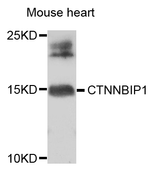 Western blot - CTNNBIP1 Polyclonal Antibody 