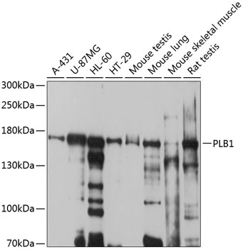Western blot - PLB1 Polyclonal Antibody 