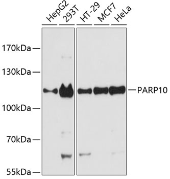 Western blot - PARP10 Polyclonal Antibody 