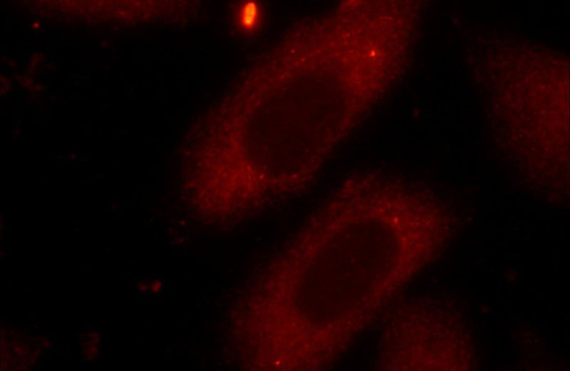 Immunofluorescent analysis of HepG2 cells using Catalog No:110753(FXR2 Antibody) at dilution of 1:25 and Rhodamine-Goat anti-Rabbit IgG