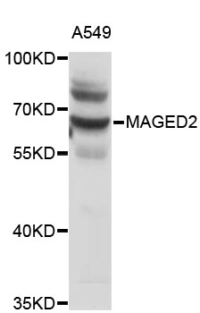Western blot - MAGED2 Polyclonal Antibody 