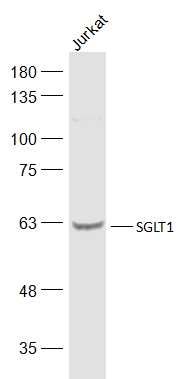 Fig1: Sample:; Jurkat(Human) Cell Lysate at 30 ug; Primary: Anti-SGLT1 at 1/500 dilution; Secondary: IRDye800CW Goat Anti-Rabbit IgG at 1/20000 dilution; Predicted band size: 73 kD; Observed band size: 60 kD