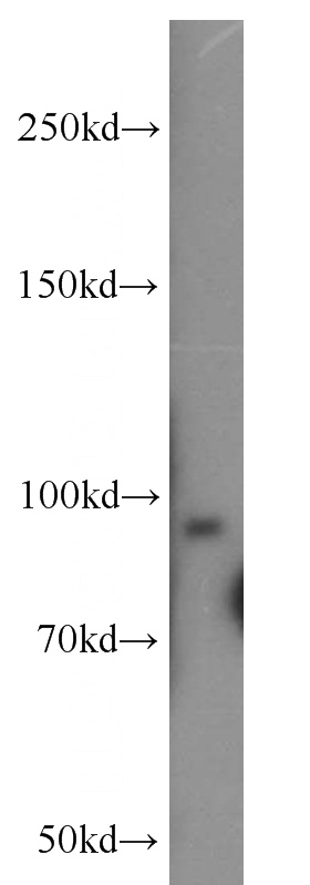 human skeletal muscle tissue were subjected to SDS PAGE followed by western blot with Catalog No:116614(UNC45B antibody) at dilution of 1:500