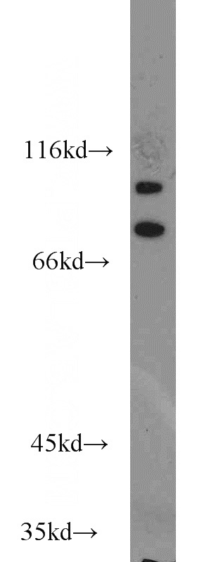 human brain tissue were subjected to SDS PAGE followed by western blot with Catalog No:108720(C3orf20 antibody) at dilution of 1:500