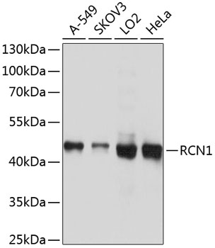 Western blot - RCN1 Polyclonal Antibody 