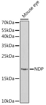 Western blot - NDP Polyclonal Antibody 