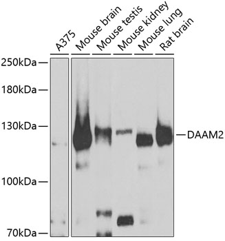 Western blot - DAAM2 Polyclonal Antibody 