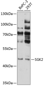 Western blot - SGK2 Polyclonal Antibody 