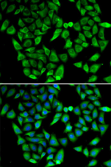 Immunofluorescence - ASIP Polyclonal Antibody 