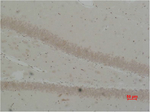 Fig2:; Immunohistochemical analysis of paraffin-embedded Rat Brain Tissue using BEST2 Polyclonal Antibody.