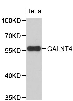 Western blot - GALNT4 Polyclonal Antibody 