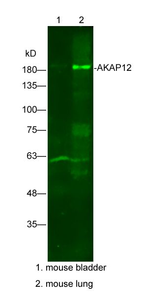 Fig3: Sample:; Lane 1: mouse bladder Lysate at 25 ug; Lane 2: mouse lung Lysate at 25 ug; Primary: Anti-AKAP12 at 1/300 dilution; Secondary: IRDye800CW Goat Anti-Rabbit IgG at 1/20000 dilution; Predicted band size: 191kD; Observed band size: 191kD