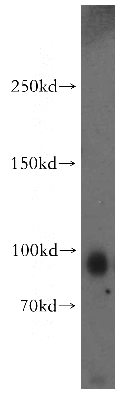 human brain tissue were subjected to SDS PAGE followed by western blot with Catalog No:112003(KIF19 antibody) at dilution of 1:300