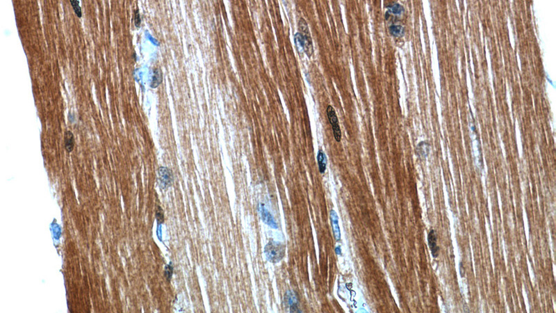 Immunohistochemical of paraffin-embedded human skeletal muscle using Catalog No:110254(ENO3 antibody) at dilution of 1:50 (under 40x lens)