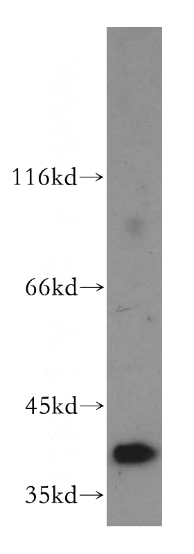 human testis tissue were subjected to SDS PAGE followed by western blot with Catalog No:114919(RRAGB antibody) at dilution of 1:500