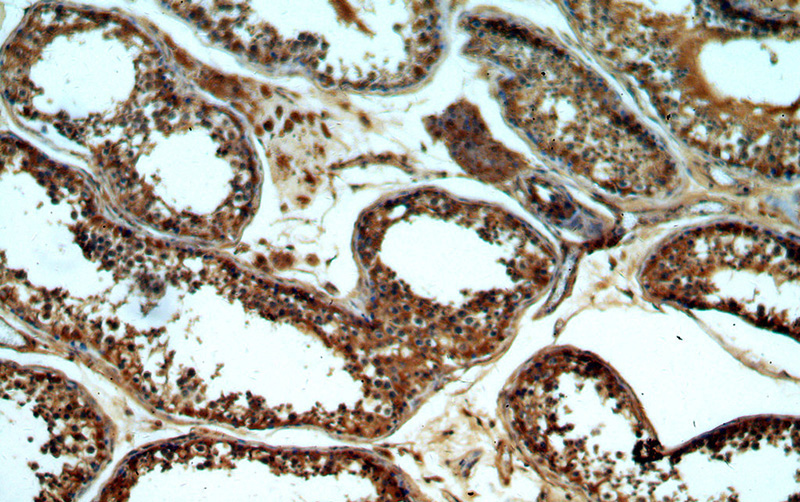 Immunohistochemical of paraffin-embedded human testis using Catalog No:111011(GNRHR antibody) at dilution of 1:50 (under 10x lens)