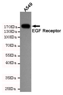 Western blot detection of EGFR in A549 cell lysates using EGFR mouse mAb(dilution 1:2000).Predicted band size:134 Kda.Observed band size:175KDa.