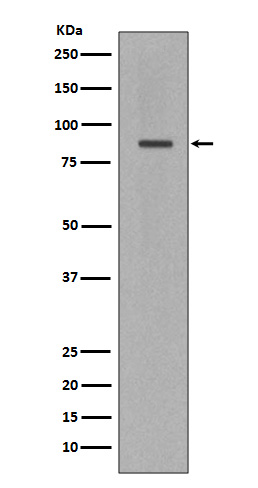 Western blot analysis of Cleaved PARP expression in Jurkat cell lysate.