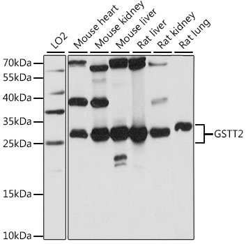 Western blot - GSTT2 Polyclonal Antibody 