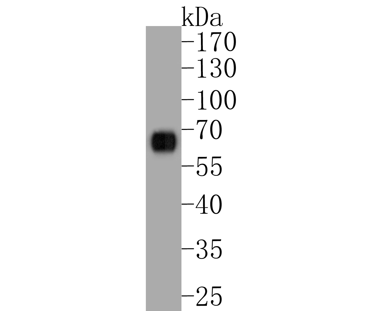 Fig1:; Western blot analysis of GSDMC on human stomach tissue lysates. Proteins were transferred to a PVDF membrane and blocked with 5% BSA in PBS for 1 hour at room temperature. The primary antibody ( 1/1000) was used in 5% BSA at room temperature for 2 hours. Goat Anti-Rabbit IgG - HRP Secondary Antibody (HA1001) at 1:5,000 dilution was used for 1 hour at room temperature.