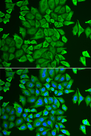 Immunofluorescence - APEH Polyclonal Antibody 