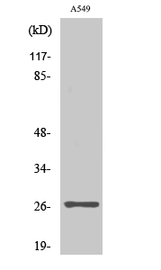 Fig1:; Western Blot analysis of various cells using NET-5 Polyclonal Antibody diluted at 1: 2000