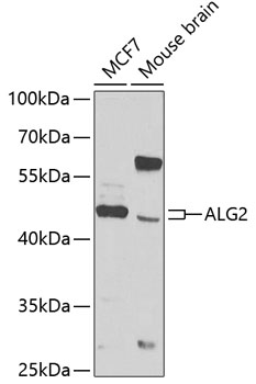 Western blot - ALG2 Polyclonal Antibody 