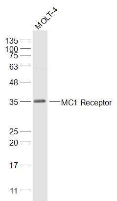 Fig2: Sample:; MOLT-4(Human) Cell Lysate at 30 ug; Primary: Anti-MC1 Receptor at 1/1000 dilution; Secondary: IRDye800CW Goat Anti-Rabbit IgG at 1/20000 dilution; Predicted band size: 35 kD; Observed band size: 35 kD
