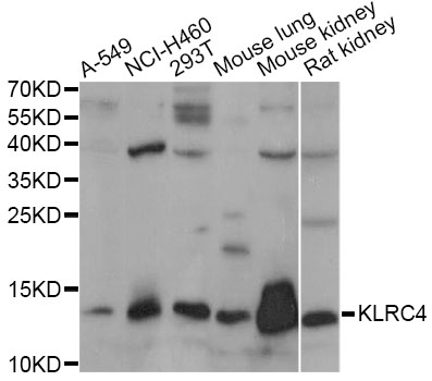 Western blot - KLRC4 Polyclonal Antibody 