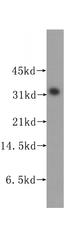 human heart tissue were subjected to SDS PAGE followed by western blot with Catalog No:115729(STOM antibody) at dilution of 1:500