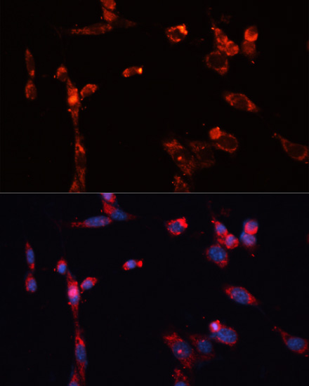 Immunofluorescence - MMP16 Polyclonal Antibody 