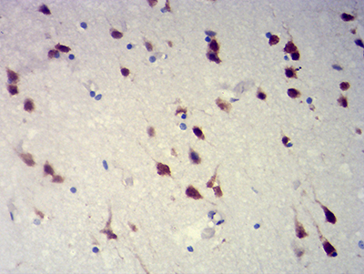 Fig3: Immunohistochemical analysis of paraffin-embedded brain tissues using anti-RBFOX2 antibody. The section was pre-treated using heat mediated antigen retrieval with Tris-EDTA buffer (pH 8.0) for 20 minutes. The tissues were blocked in 5% BSA for 30 minutes at room temperature, washed with ddH2O and PBS, and then probed with the primary antibody ( 1/100) for 30 minutes at room temperature. The detection was performed using an HRP conjugated compact polymer system. DAB was used as the chromogen. Tissues were counterstained with hematoxylin and mounted with DPX.