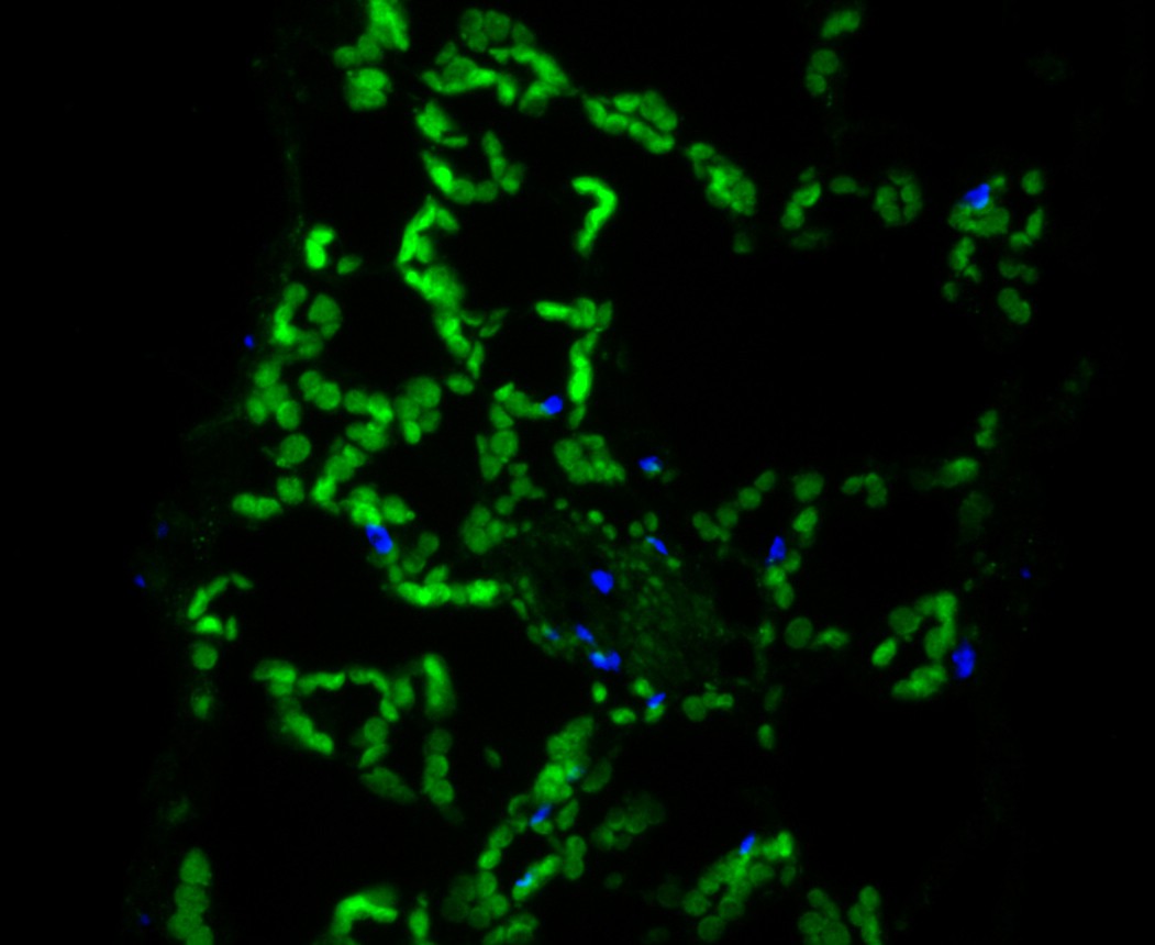 Fig1:; IF staining of ECH in Arabidopsis thaliana leaf tissue (green). The nuclear counter stain is DAPI (blue). Cells were fixed in paraformaldehyde, permeabilised with 0.25% Triton X100/PBS.