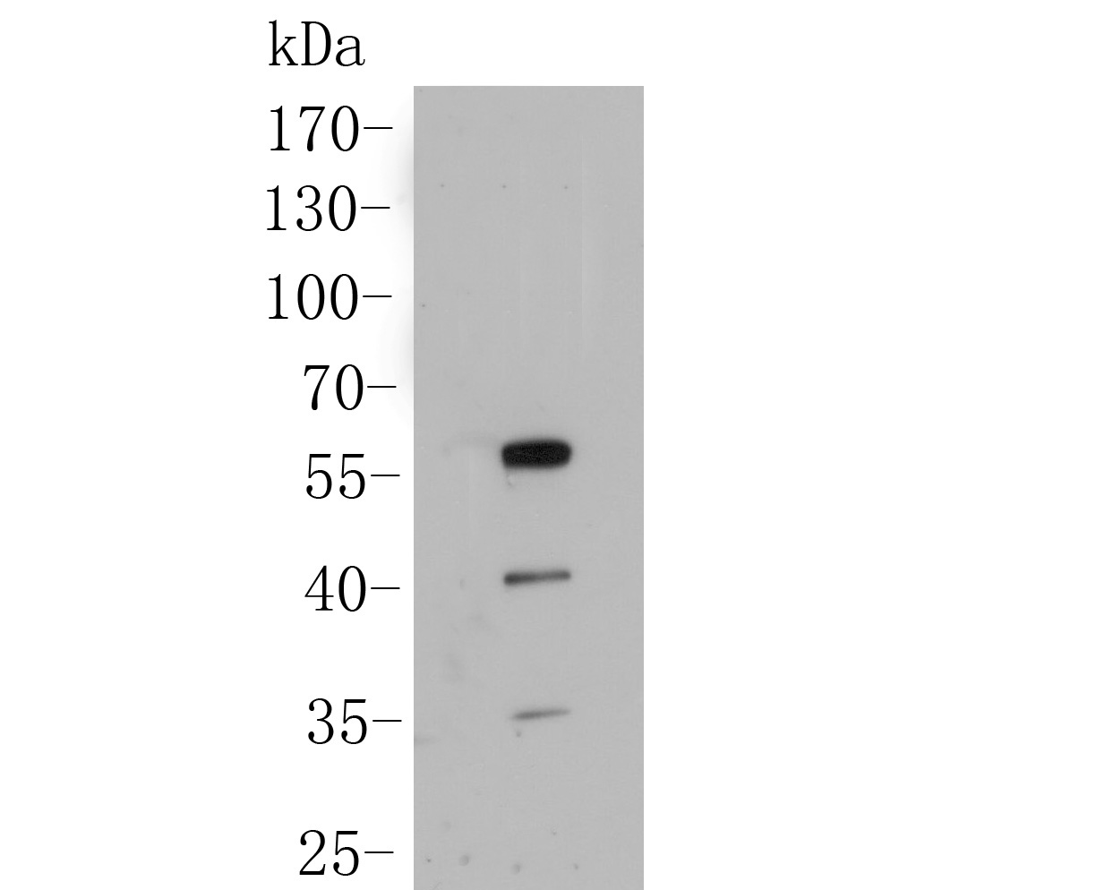 Fig3:; Western blot analysis of SHE on Zebrafish tissue lysate. Proteins were transferred to a PVDF membrane and blocked with 5% BSA in PBS for 1 hour at room temperature. The primary antibody ( 1/500) was used in 5% BSA at room temperature for 2 hours. Goat Anti-Rabbit IgG - HRP Secondary Antibody (HA1001) at 1:5,000 dilution was used for 1 hour at room temperature.