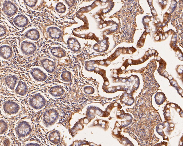 Fig4:; Immunohistochemical analysis of paraffin-embedded human small intestine tissue using anti-SLFN12 antibody. The section was pre-treated using heat mediated antigen retrieval with Tris-EDTA buffer (pH 8.0-8.4) for 20 minutes.The tissues were blocked in 5% BSA for 30 minutes at room temperature, washed with ddH; 2; O and PBS, and then probed with the primary antibody ( 1/50) for 30 minutes at room temperature. The detection was performed using an HRP conjugated compact polymer system. DAB was used as the chromogen. Tissues were counterstained with hematoxylin and mounted with DPX.