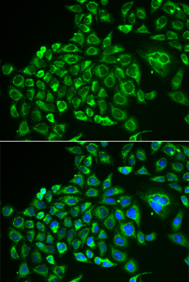 Immunofluorescence - RCVRN Polyclonal Antibody 
