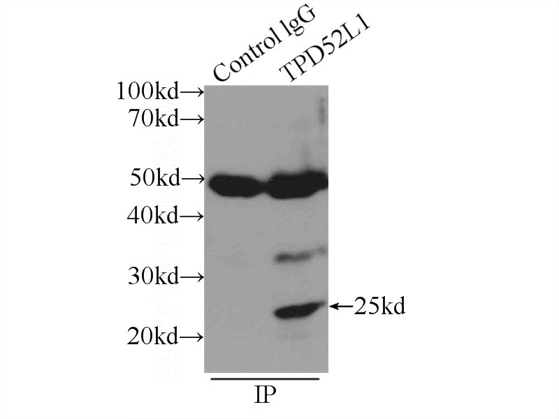 IP Result of anti-hD53; TPD52L1 (IP:Catalog No:111369, 3ug; Detection:Catalog No:111369 1:300) with MCF-7 cells lysate 2500ug.