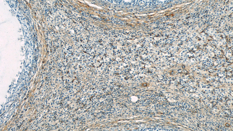 Immunohistochemical of paraffin-embedded human ovary using Catalog No:115115(SEPT11 antibody) at dilution of 1:50 (under 10x lens)