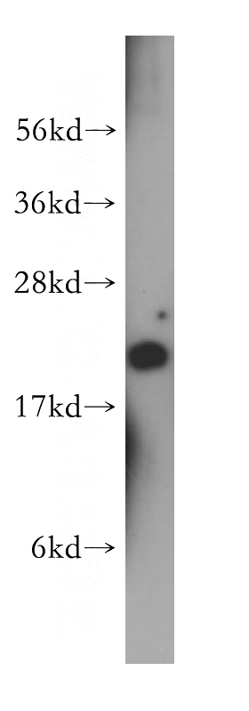 HeLa cells were subjected to SDS PAGE followed by western blot with Catalog No:114812(RPL12 antibody) at dilution of 1:400