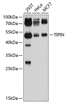 Western blot - TIPIN Polyclonal Antibody 