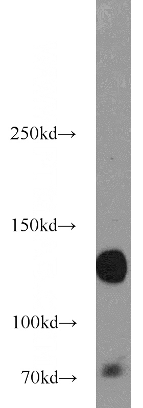 3T3-L1 cells were subjected to SDS PAGE followed by western blot with Catalog No:111860(ITGA5 antibody) at dilution of 1:1000