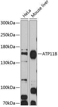Western blot - ATP11B Polyclonal Antibody 