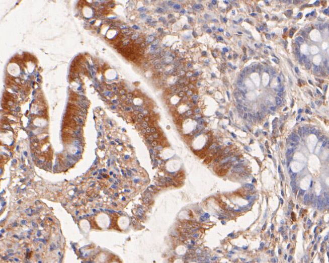Fig7:; Immunohistochemical analysis of paraffin-embedded human small intestine tissue using anti-NHE-1 antibody. The section was pre-treated using heat mediated antigen retrieval with Tris-EDTA buffer (pH 8.0-8.4) for 20 minutes.The tissues were blocked in 5% BSA for 30 minutes at room temperature, washed with ddH; 2; O and PBS, and then probed with the primary antibody ( 1/50) for 30 minutes at room temperature. The detection was performed using an HRP conjugated compact polymer system. DAB was used as the chromogen. Tissues were counterstained with hematoxylin and mounted with DPX.