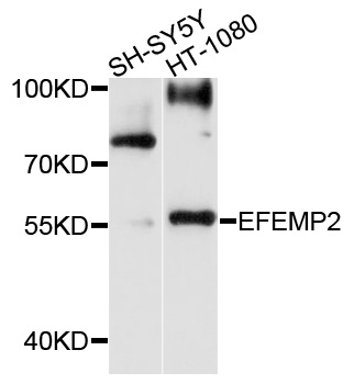 Western blot - EFEMP2 Polyclonal Antibody 