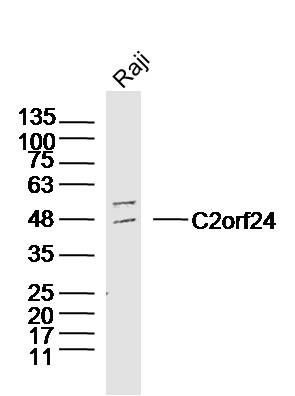 Fig1: Sample: Raji Cell (Human) Lysate at 30 ug; Primary: Anti-C2orf24 at 1/300 dilution; Secondary: IRDye800CW Goat Anti-Rabbit IgG at 1/20000 dilution; Predicted band size: 45kD; Observed band size: 47kD