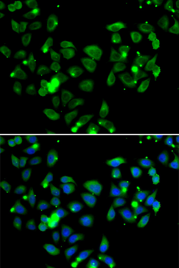 Immunofluorescence - CARD11 Polyclonal Antibody 