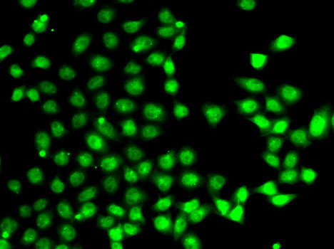 Immunofluorescence - EAF2 Polyclonal Antibody 