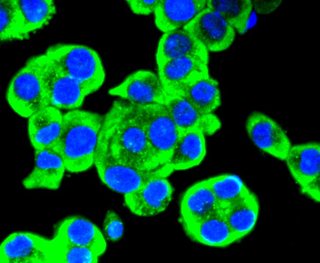 Fig4:; ICC staining of Ret in SW480 cells (green). Formalin fixed cells were permeabilized with 0.1% Triton X-100 in TBS for 10 minutes at room temperature and blocked with 1% Blocker BSA for 15 minutes at room temperature. Cells were probed with the primary antibody ( 1/50) for 1 hour at room temperature, washed with PBS. Alexa Fluor®488 Goat anti-Rabbit IgG was used as the secondary antibody at 1/1,000 dilution. The nuclear counter stain is DAPI (blue).